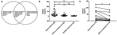 Renal Expression of Annexin A1 Is Associated With the Severity of Renal Injury in Antineutrophil Cytoplasmic Autoantibody-Associated Vasculitis